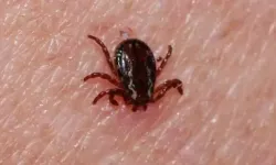 Çankırı'da Kenenin Isırdığı 5 Çocuk Annesi Öldü!