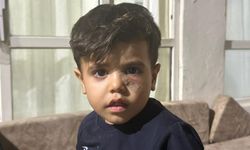 Yorgun Mermi, 4 Yaşındaki Çocuğun Gözünün Altına İsabet Etti