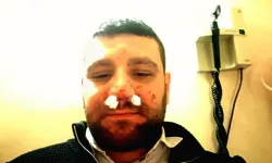 Trafikte yol verme tartışmasında avukatın burnu kırıldı