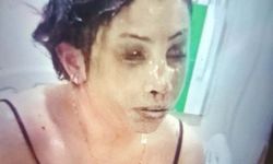 Boşanma aşamasındaki eşini koli bandı ile bağlayıp, başından aşağı kezzap döktü