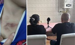 Kreşte çocuğa şiddet soruşturması; 1 şüpheli tutuklandı