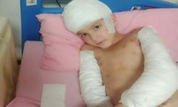 Sokak köpeklerinin saldırısında yaralanan Tunahan'ın ailesine, 5 milyon TL manevi tazminat ödenecek