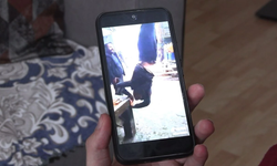 Ayağından vince asılan zihinsel engelli Hamza: Çekindim, aileme bile anlatamadım