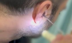 Kulağına gizlediği uyuşturucuyla yakalandı