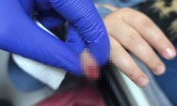 Yürüyen merdivene eli sıkışan çocuğun kopan parmağı kurtarılamadı