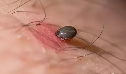 Tokat'ta KKKA hastalığı şüphesiyle tedavi gören kadın hayatını kaybetti