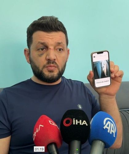 İkra bebeğin darbedildiği iddia edilen kavganın güvenlik kamerası görüntüleri ortaya çıktı