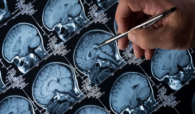 Lityum Alzheimer'ı Durdurabilir mi? Yeni Araştırma Umut Verdi