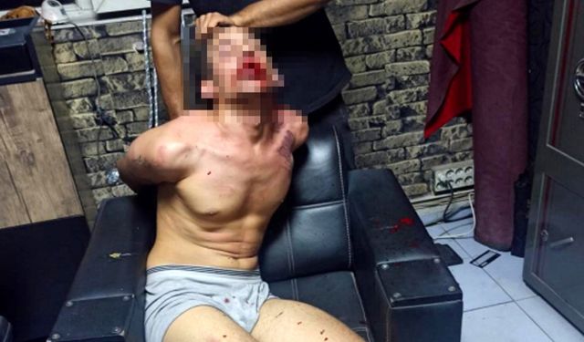 Böcek Yedirip, Dişlerini Kırdılar; Savcı 20'şer Yıl Hapis Cezası İstedi