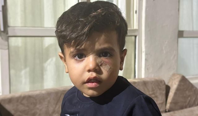 Yorgun Mermi, 4 Yaşındaki Çocuğun Gözünün Altına İsabet Etti