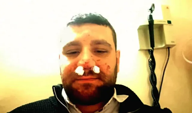 Trafikte yol verme tartışmasında avukatın burnu kırıldı