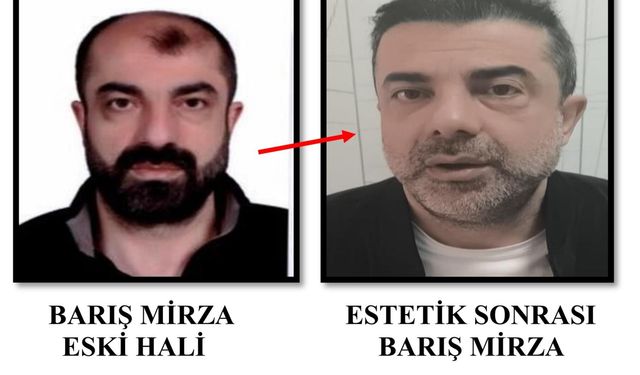 Cinayete azmettirmekten aranan şüpheli, ameliyatla yüzünü değiştirmiş