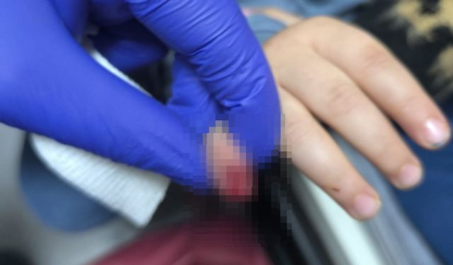 Yürüyen merdivene eli sıkışan çocuğun kopan parmağı kurtarılamadı