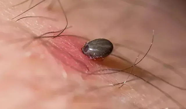 Tokat'ta KKKA hastalığı şüphesiyle tedavi gören kadın hayatını kaybetti