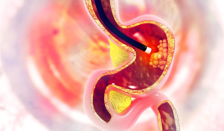 'Çoğu zaman endoskopi ve kolonoskopi yapılmasının nedeni, gereksiz yere kullanılan aspirin'