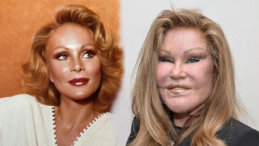 'Kedi Kadın' Jocelyn Wildenstein, Hayatını Kaybetti-1