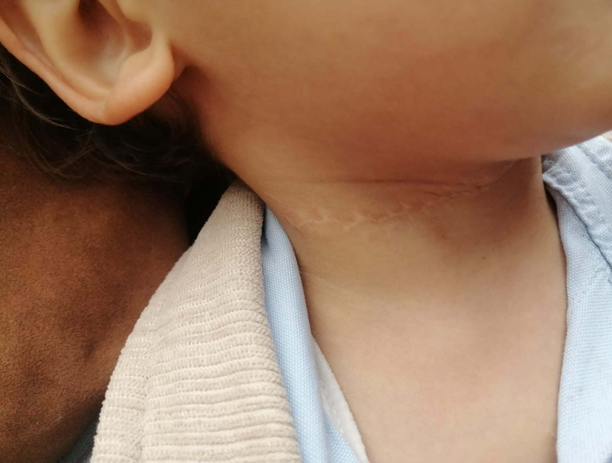 15 Y A S I N D A K I C O C U G U N B O Y N U N U K E S E N S A N I 991212 294085