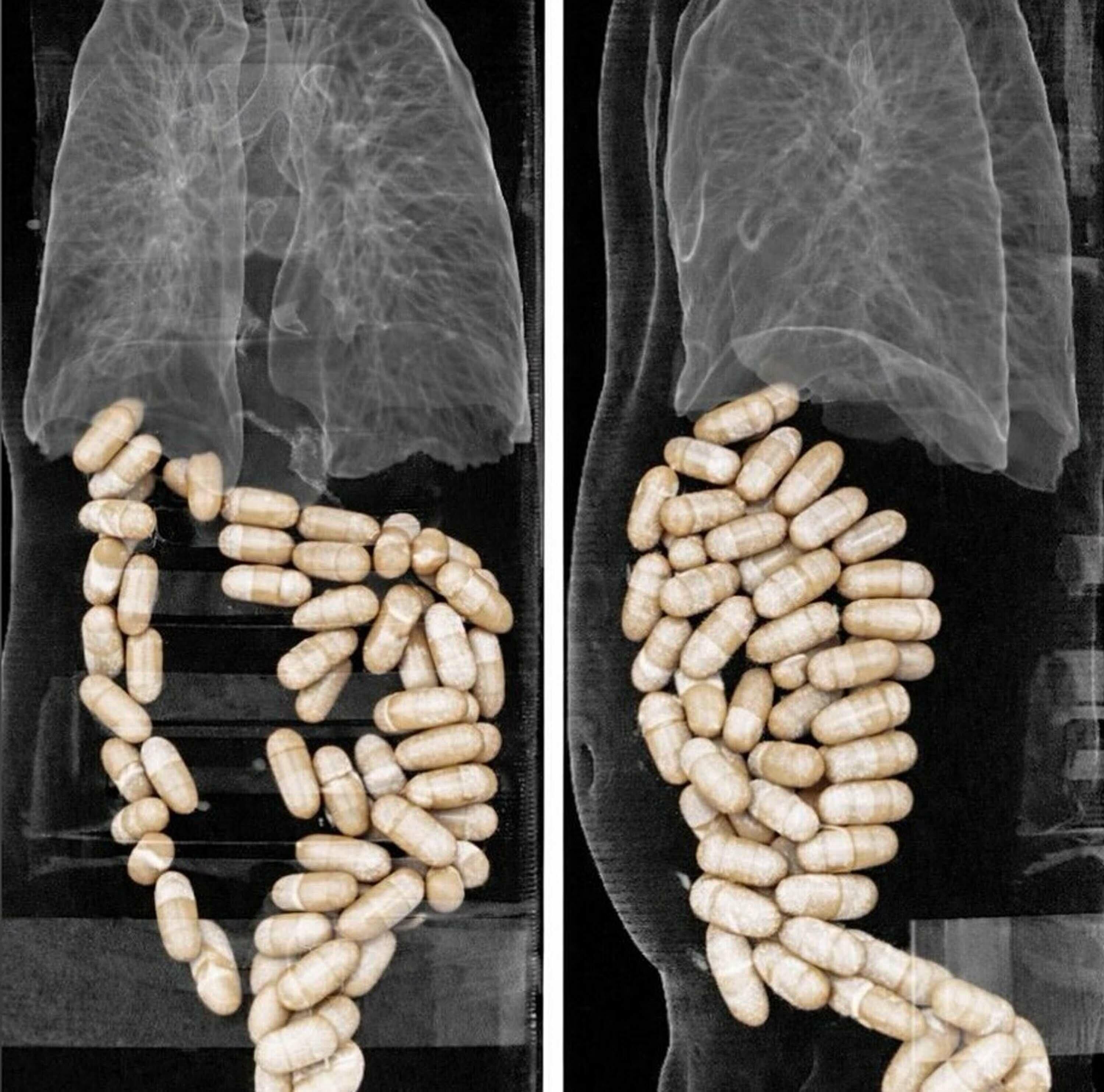 2 S U P H E L I N I N M I D E S I N D E N 127 K A P S U L U Y U S T 1248674 371487